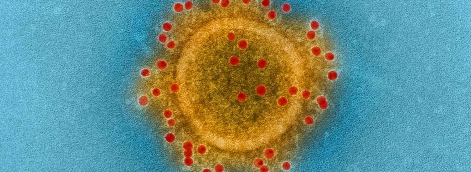 Coronavirus