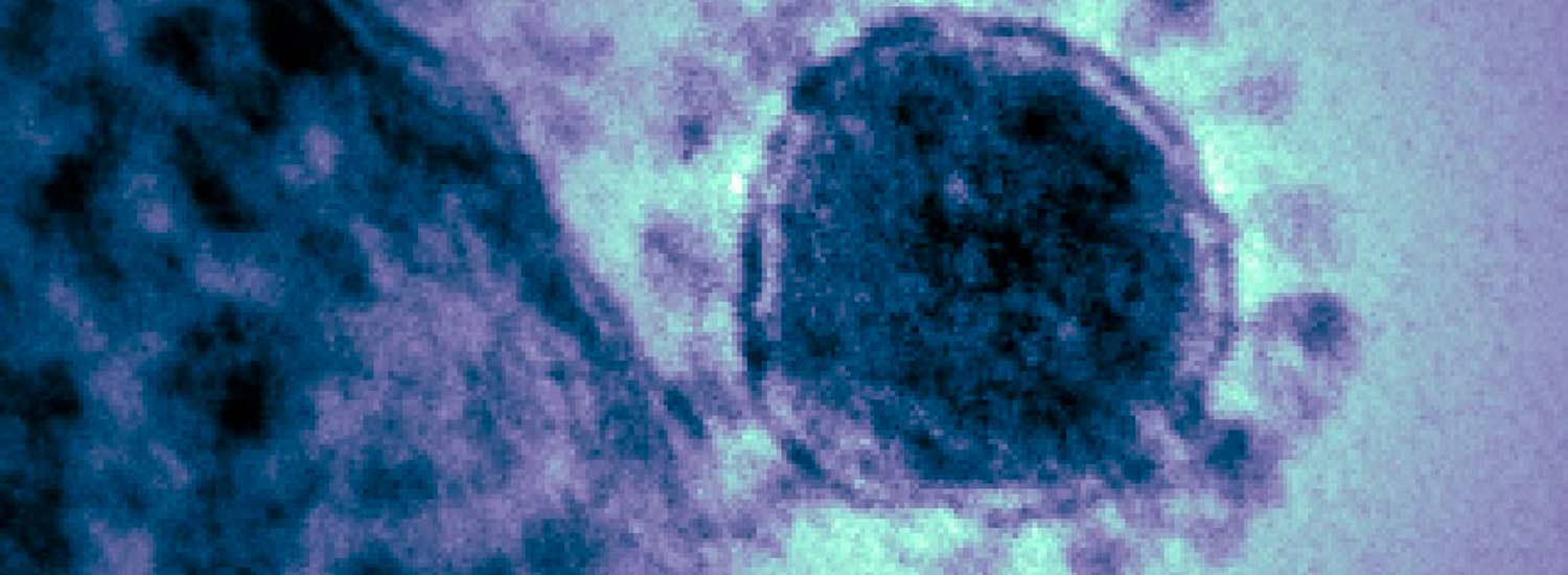 Coronavirus